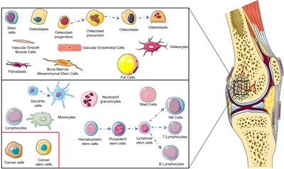 Novel Immunotherapies for Osteosarcoma